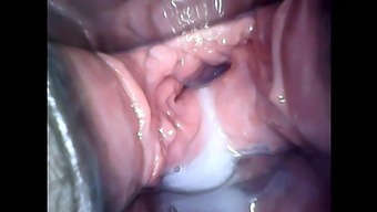 Speculum observation during continuous vaginal creampie